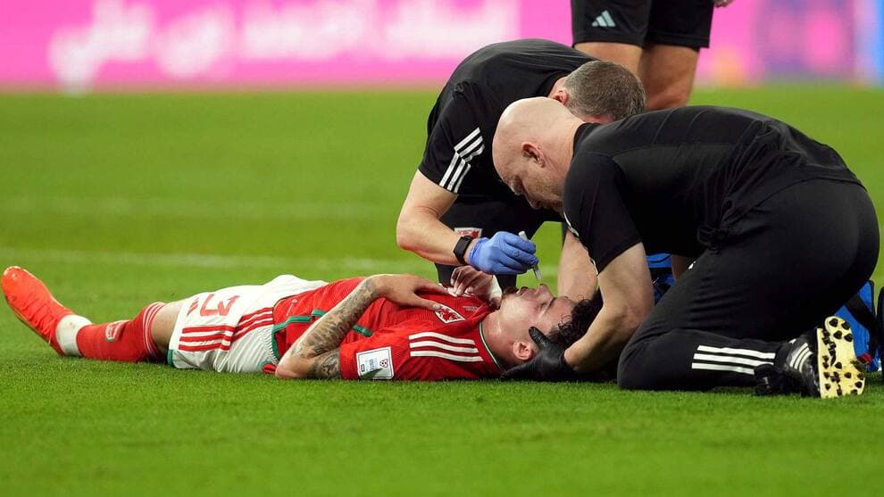 La FIFA presentó un protocolo de evaluación de conmociones cerebrales en menos de tres minutos